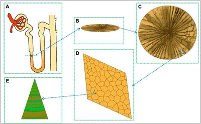 Osteopontin: An important protein in the formation of kidney stones